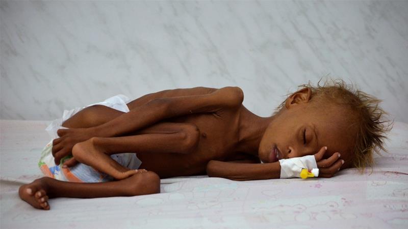 UNICEF: One child dies every 10 minutes in Yemen