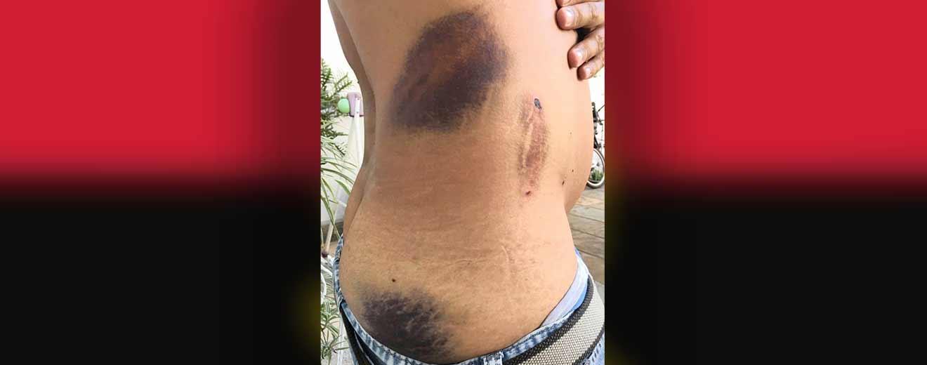 Angola police beat and set dogs on protesters