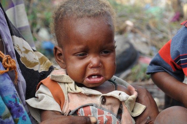 In a “World of Plenty,” G7 Must Fight Famine