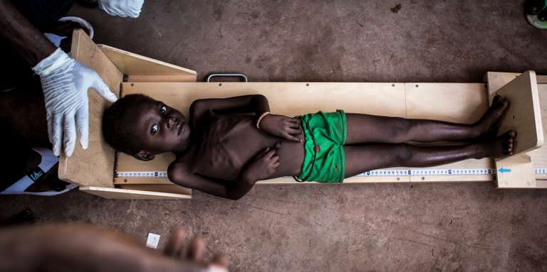 RDC : la faim, nouvelle menace pour les rescapés des violences au Kasaï