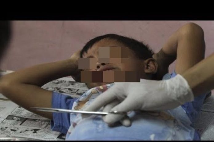 Inde: Il coupe le pénis de son fils de 13 ans et le laisse mourir pour chasser les mauvais esprits