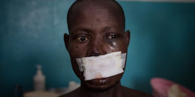 L’orrore nella Repubblica Centrafricana: in 30mila in fuga dalle violenze