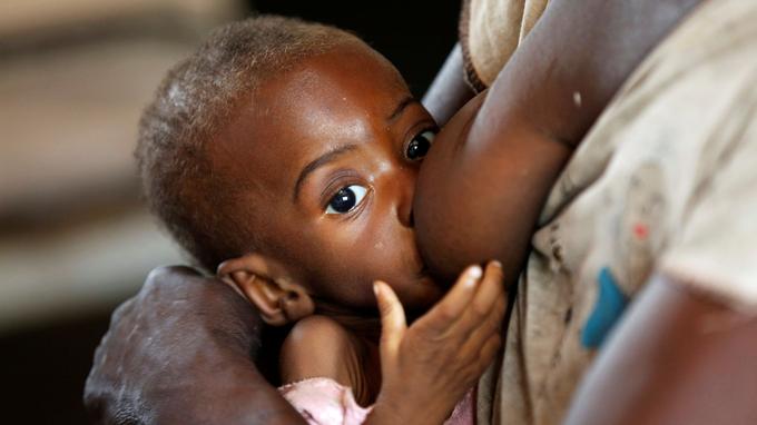 RDC: 400.000 enfants risquent de mourir de malnutrition sévère