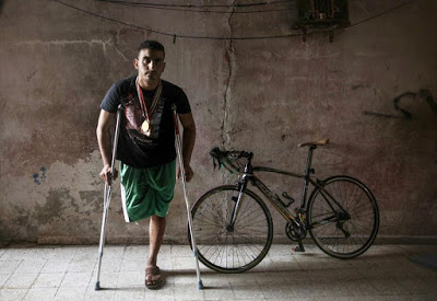Gaza : «Il manquait 12 centimètres d’os, la jambe pendouillait»