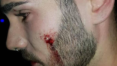 Agresión homófoba en una discoteca de Alcorcón: “Aquí no queremos maricones”