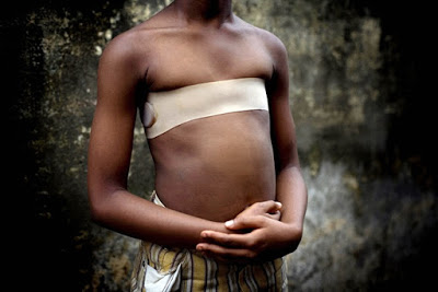 Lo stiramento del seno, la pratica disumana dal Camerun