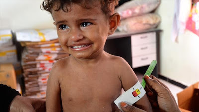 ‘Killing a generation’: Five million Yemeni children face famine