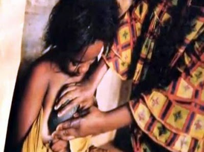 L’Appiattimento del seno nelle camerunensi e nigeriane. La prima segnalazione per l’Italia.
