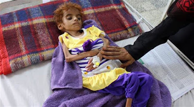 I peggiori crimini dell’Arabia Saudita sono nello Yemen (con la complicità USA)