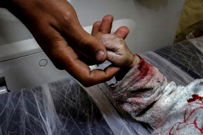 Gaza 2020: com’è facile per il mondo cancellare il dolore palestinese